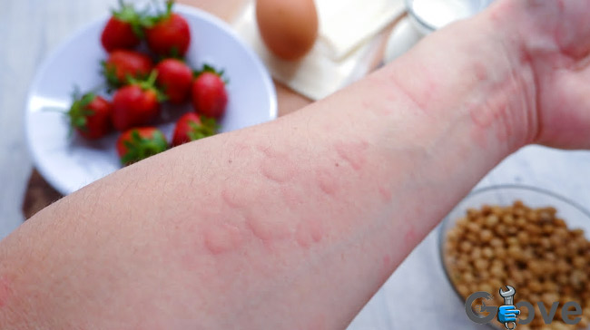 What-fruits-should-you-avoid-if-you-have-a-latex-allergy.jpg